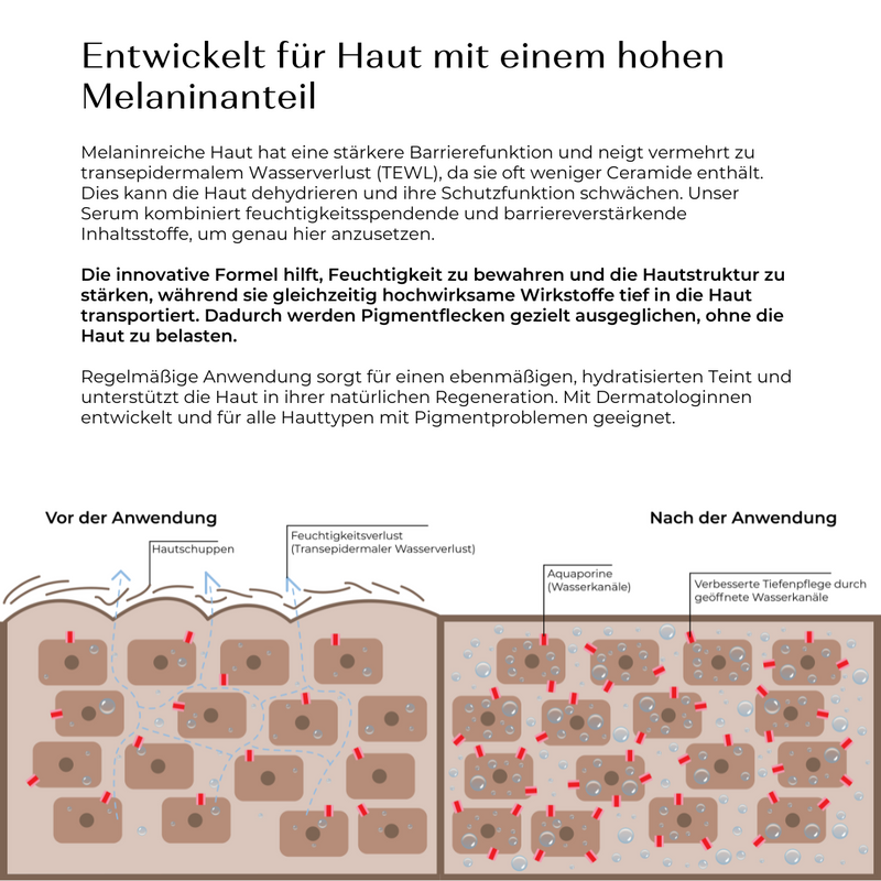 HYPERPIGMENTATION SERUM gegen Dark Spots und Pigmentflecken